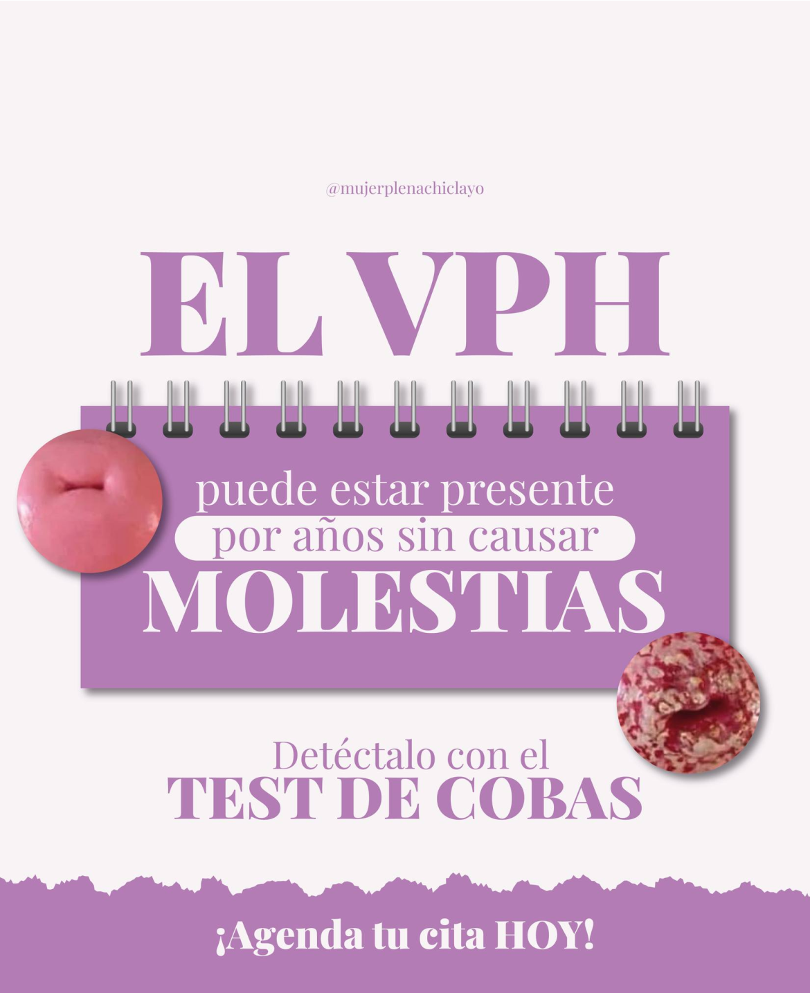 Ecografía ginecológica en Chiclayo